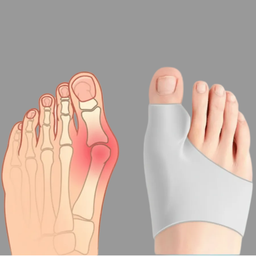 CompressCare Teen - Hallux Valgus Corrector for Enhanced Comfort & Support 7