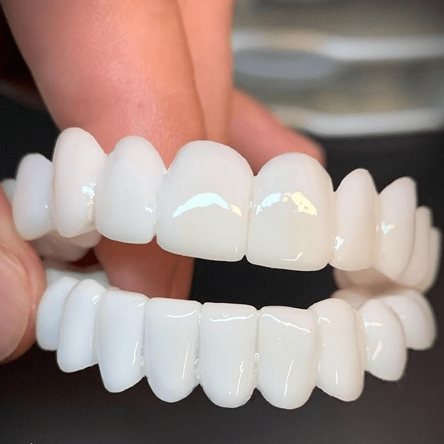 SMILEFLEX – Dental Prosthesis with White Dental Lenses 0