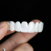 SMILEFLEX – Dental Prosthesis with White Dental Lenses 3