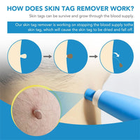 SPOTOFF - Skin Spot Remover for Easy and Targeted Use to Care for Skin Imperfections on the Body 6