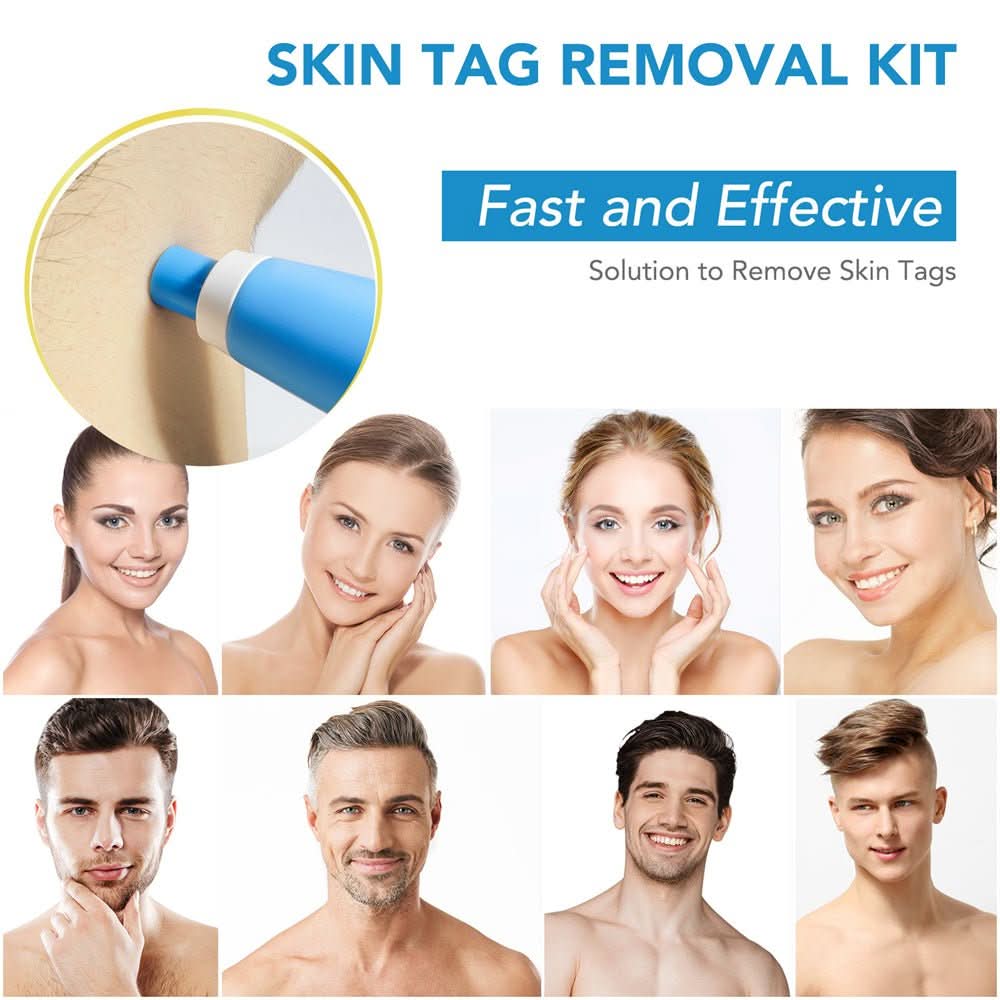 SPOTOFF - Skin Spot Remover for Easy and Targeted Use to Care for Skin Imperfections on the Body 7